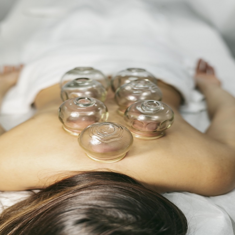 Professional Cupping Therapy for Mind & Body Relief